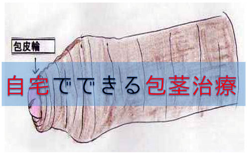 sƁAJyjXɂIŉs6̕@