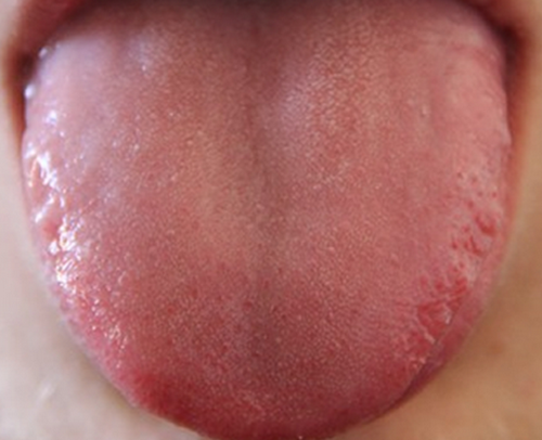 yg̉`z̉AjENgXӂ߂ŖuNÏ