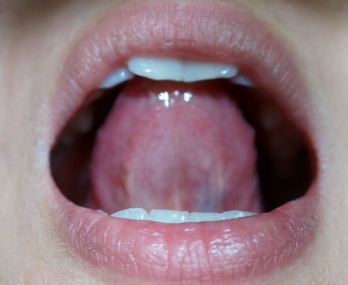 yg̉`z̉AjENgXӂ߂ŖuNÏ