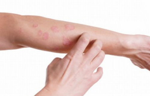 Tvg̕pAAM[́Hʂ̉ߏێ͌